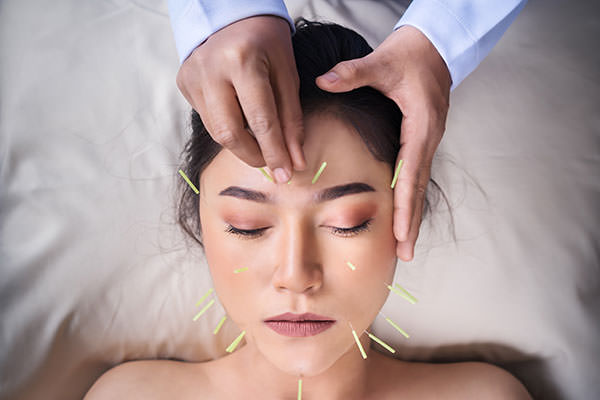 Wink and Wave Toronto 5 Benefits of Facial Acupuncture