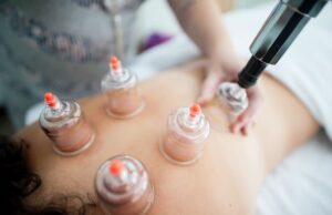 Wink and Wave Toronto Cupping Therapy with RMT Massages